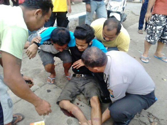 kaki kanan patah.jpg image