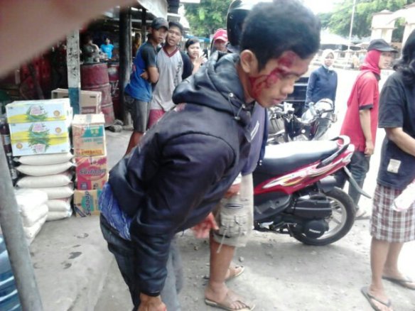 korban kecelakaan.jpg image